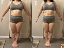 ヴィエーゾ(VIESO)/ビフォーアフター