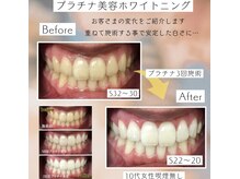 ホワイトニングプラス(Whitening+)の雰囲気（歯科衛生士在籍！しっかりサポートさせていただきます(^^♪）