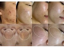 アテ 国分寺店(Ate)