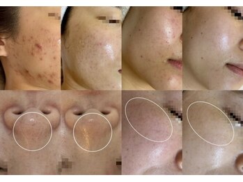 アテ 国分寺店(Ate)