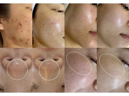 アテ 国分寺店(Ate)の写真