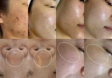 アテ 国分寺店(Ate)