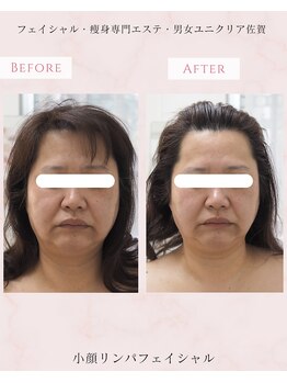 ユニクリア(Uni clear)/佐賀市│小顔リンパフェイシャル
