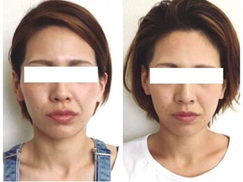 美容整体 ウェリナ 蟹江院/小顔矯正/骨盤矯正/美脚サロン