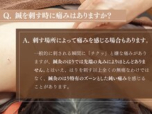 鍼灸ライフ整骨院/鍼を刺す時に痛みはありますか？