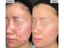 スリリアン 銀座/★お客さまビフォーアフター★