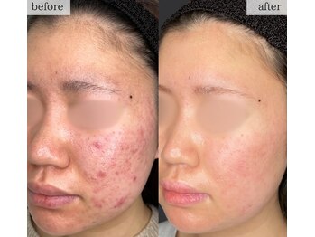 スリリアン 銀座/★お客さまビフォーアフター★