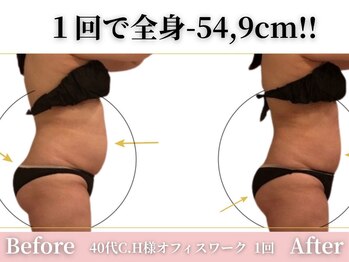 アメリイ 百合ヶ丘 新百合ヶ丘(Amerii)/【痩身】1回で全身-54,9cm痩せ!