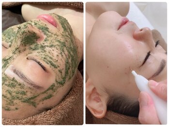 ルタンリッシュ ハナレ(Lutan Riche 花麗)の写真/ハーブピーリング+シミケア5ｐの贅沢コースが初回¥19800→¥9900☆お肌の土台を整えながら濃いシミも改善♪