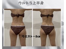 フルーア(FULUA)/ウルトランスフォーマー上半身