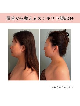 ぬくもりのおとの写真/【骨格×筋肉×肌にトリプルアプローチ】驚きの小顔実感！頭蓋骨矯正＆巡りケアで、スッキリ美フェイスに◎