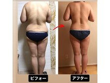 サロン ド ルルアス(Salon de LuLuas)/脂肪冷却