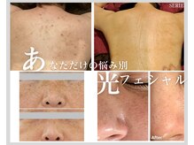 サロン エス(salon S)の雰囲気（何をしても改善されなかったシミケアで悩まれてるあなたへ♪）