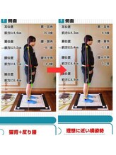 チャラク(charaku)/【10代A様：姿勢矯正】