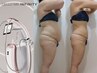 NEW【造形美ボディ】AI診断+エンダモロジー頑固セル撃破60分¥23,200→¥9,800