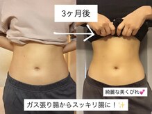 ネネ(Nene)/ビフォーアフター