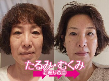 ネルジム 札幌店(NERU GYM)/美小顔☆プレミアムフルコース！