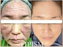 ソリッジ肌管理室/敏感肌の改善