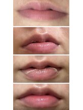 キュライム カブール町田店/1回でピンクになれる