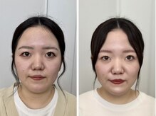 シュシュビエン(Chou Chou Bien)/トータル診断後のフルメイク♪