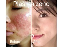 エステサロン ベルジュール/