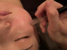 ビューティコア 二子玉川/肌の悩みは、年齢問わず
