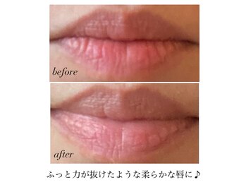 ピーロ ルレ(salon Piilo Rule)/before/after