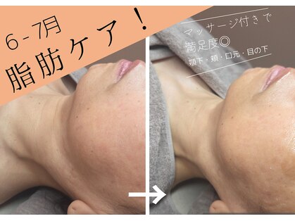 アルム(Areum)の写真