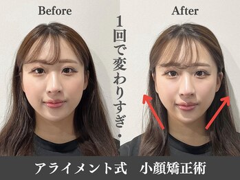 アライメント 自由が丘(Alignment)/１回で劇的改善♪