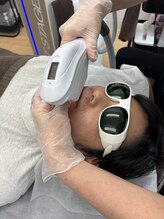 男前脱毛 鈴鹿店/施術風景（ヒゲ）