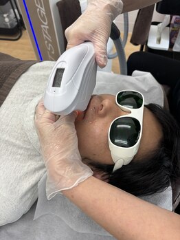 男前脱毛 鈴鹿店/施術風景（ヒゲ）