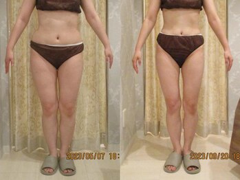 プロラボスパ 倉敷店/30代前半　症例写真