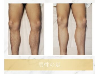 アンド エヌ(&n)/◆足脱毛◆