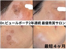 リアリア(LEALEA)