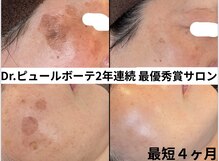 リアリア(LEALEA)