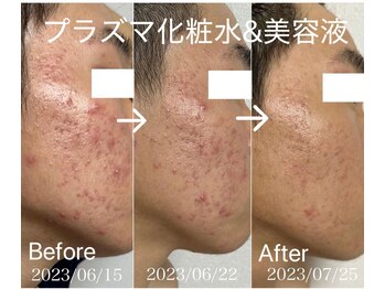 エステサロン ベルジュール/プラズマシリーズお化粧品