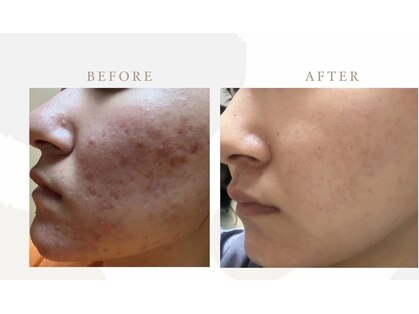 エムアイ 六本木(Mi)の写真