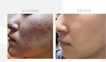 エムアイ 六本木(Mi)