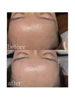 コモレビ(komorebi)/