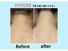 エステティック レイビス 青森店(RAYVIS)/意外と見られてる後ろ姿！