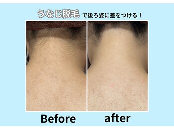 エステティック レイビス 青森店(RAYVIS)/意外と見られてる後ろ姿！