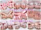 nail salon kitty【キティ】心斎橋店《フィルイン/長さ出し》【7/7 NEWOPEN（予定）】の写真