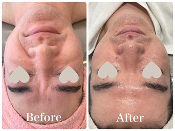 ジョアアンジェ 京橋店(joie ange)/エイジング効果も！