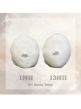 R-1ビューティーサロン 表参道/Before &After（13回）
