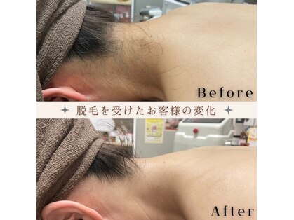 アミュレット(amulette)の写真