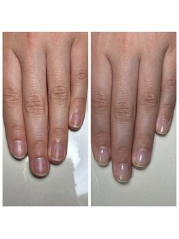 リヒネイル(Rihi.nail)/自爪育成