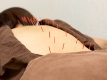 たかさきひかり鍼灸整骨院