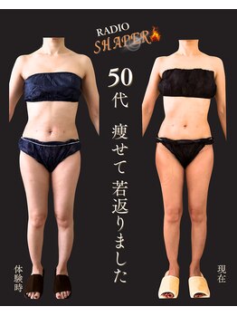 チェイン オブ フラワー(Chain Of Flower)/最先端マシン:RADIOシェイパー