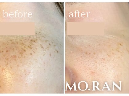 モラン(MO.RAN)の写真