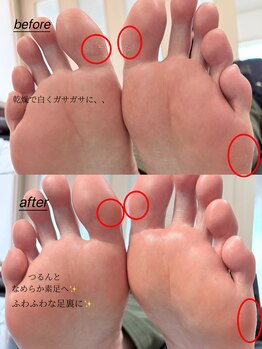 エン(en.)の写真/角質ケア/甘皮ケア/スクラブ/トリートメントケアも充実。豊富な知識で爪の悩みを改善し理想のお手元へ。
